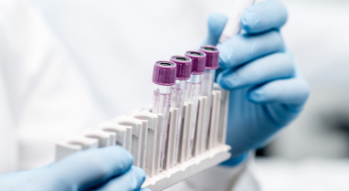 Hands with surgical gloves holding test tubes