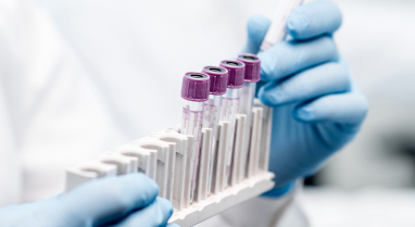 Hands with surgical gloves holding test tubes